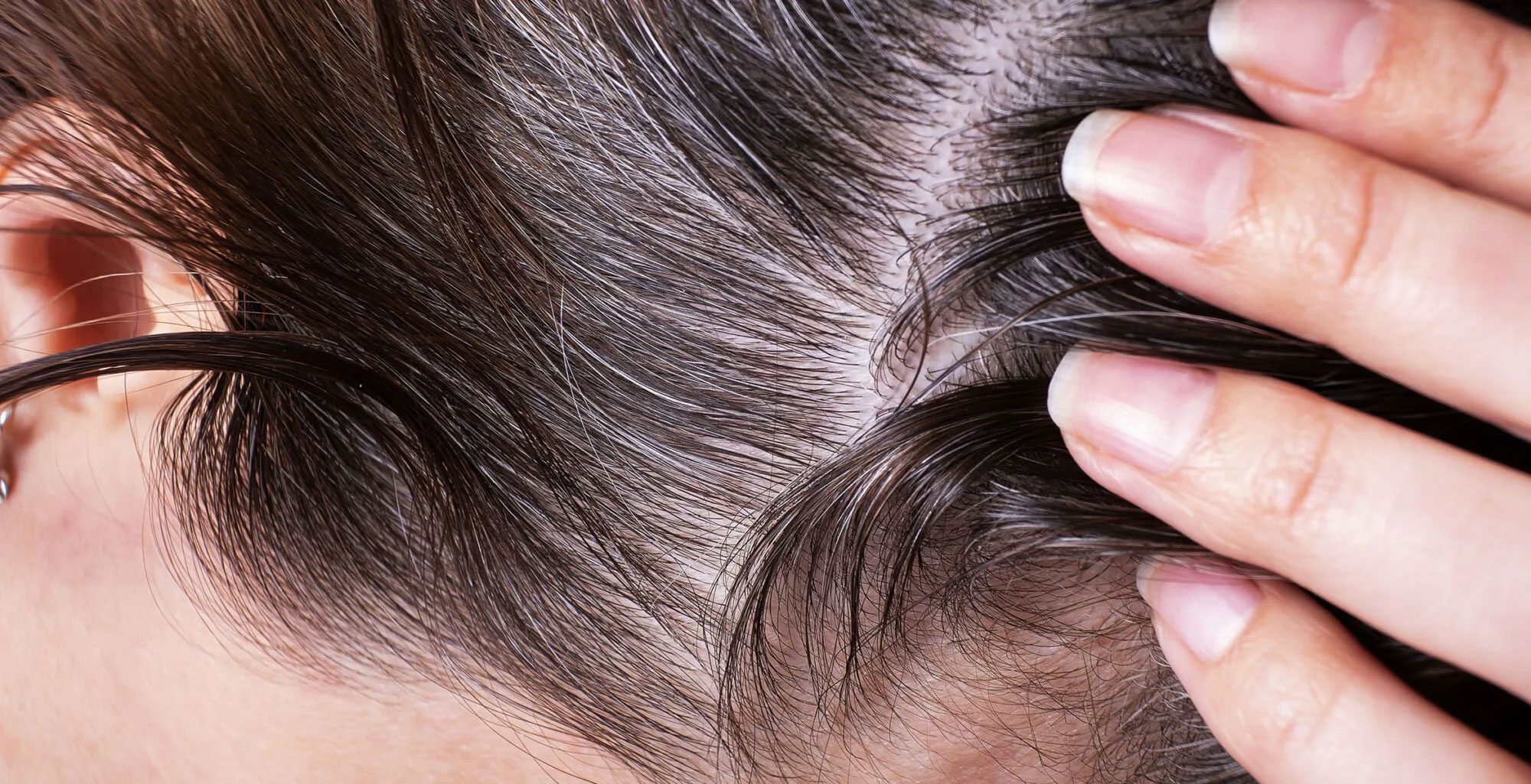 RegroX | Understanding The Scalp Microbiome: The New Frontier In Hair Health | regrox-scalp-microbiome-0001